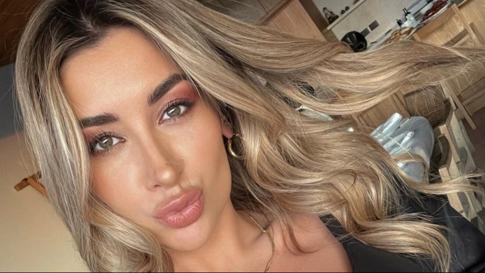 Camila Andrade niega popular procedimiento estético en su rostro y declara: 'Si lo necesito me lo pondría'