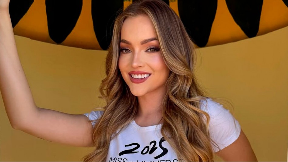 Antonia Casanova muestra detalles de su intervención estética en su preparación al Miss Universo Chile 2025