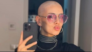 "Valoro tanto estar viva": Karla Melo se muestra empoderada con especial foto relacionada con el cáncer