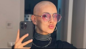 Mostró el proceso: Karla Melo luce dos nuevos y diferentes looks tras perder su cabello