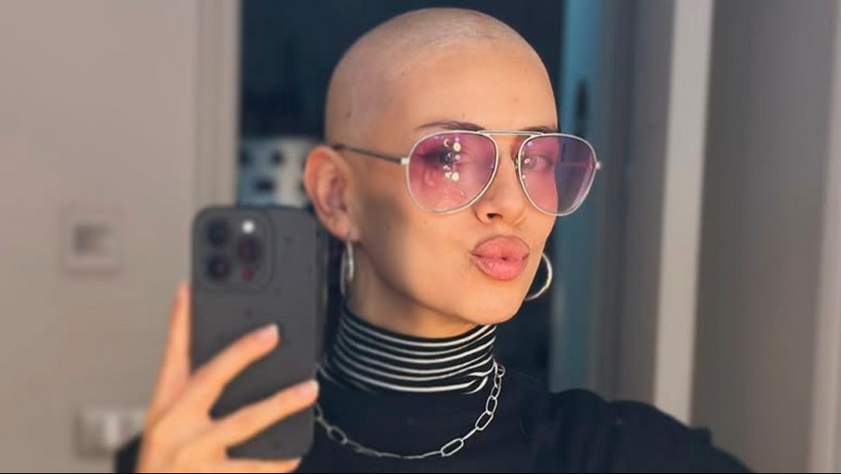 Mostró el proceso: Karla Melo luce dos nuevos y diferentes looks tras perder su cabello