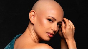 "Esta la anhelo profundamente": El emotivo sueño de Karla Melo en plena quimioterapia