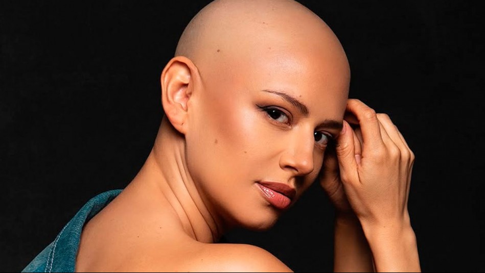 'Esta la anhelo profundamente': El emotivo sueño de Karla Melo en plena quimioterapia