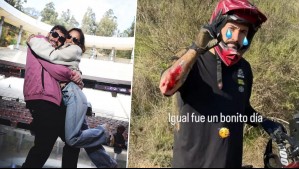 "Si se saca la cresta ahí voy a estar": Esposa de Edo Caroe actualizó estado de salud tras caída en bicicleta