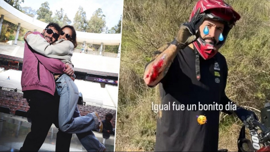 'Si se saca la cresta ahí voy a estar': Esposa de Edo Caroe actualizó estado de salud tras caída en bicicleta