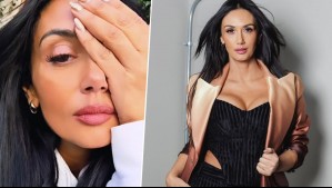Pamela Díaz se sometió a operación en su ojo: 'Fui donde el doctor y no era un orzuelo'