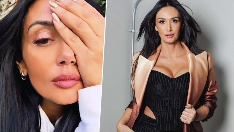 Pamela Díaz se sometió a operación en su ojo: 'Fui donde el doctor y no era un orzuelo'