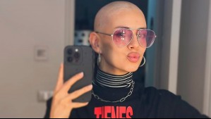 "No siempre hay que ser fuertes": Karla Melo emociona con sincera reflexión sobre su lucha contra el cáncer