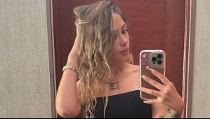 Trini Neira muestra los increíbles resultados del borrado de tatuajes de su mano y cuello