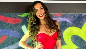 Para 'reactivar' el colágeno: Yamna Lobos muestra el novedoso tratamiento al que se sometió