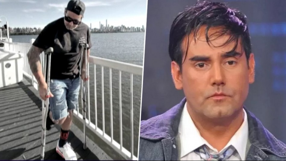 Ahora vive en Estados Unidos: La razón que llevó a Ronny Dance a ser operado tres veces