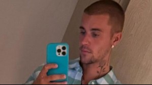 ¿Las comprarías? Estas son las pantuflas de 180 mil pesos de la nueva marca de Justin Bieber