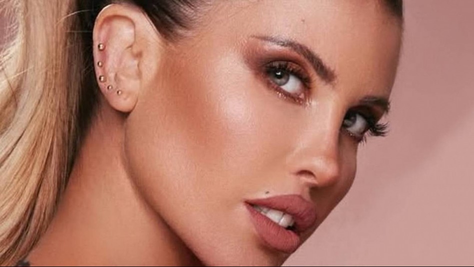 Coté López sufrió accidente de tránsito: Motorista involucrado terminó con fracturas