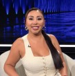 Naya Fácil se sometió a un implante capilar en Talca y mostró el antes y después del procedimiento, explicando cada detalle y cuidados que debe tener.