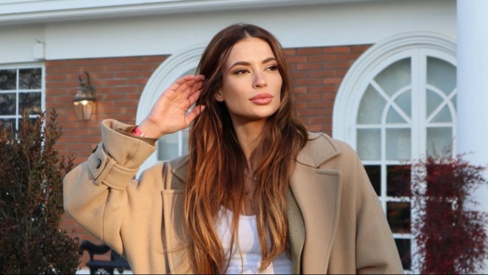 'La cara es mía': Julia Fernandes responde sin filtro a quienes la critican por el aspecto de su rostro