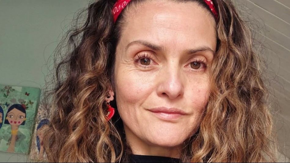 A 5 días del tratamiento: Connie Achurra actualizó cómo ha avanzado el botox para evitar las jaquecas