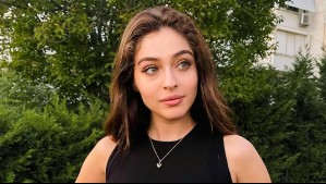 'No hay de qué preocuparse': Cemre Baysel envía un mensaje a sus fans tras someterse a una cirugía