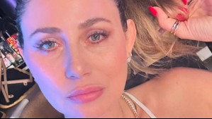 Gissella Gallardo sufre severa lesión por estar distraída en su teléfono: "El karma me pegó fuerte"