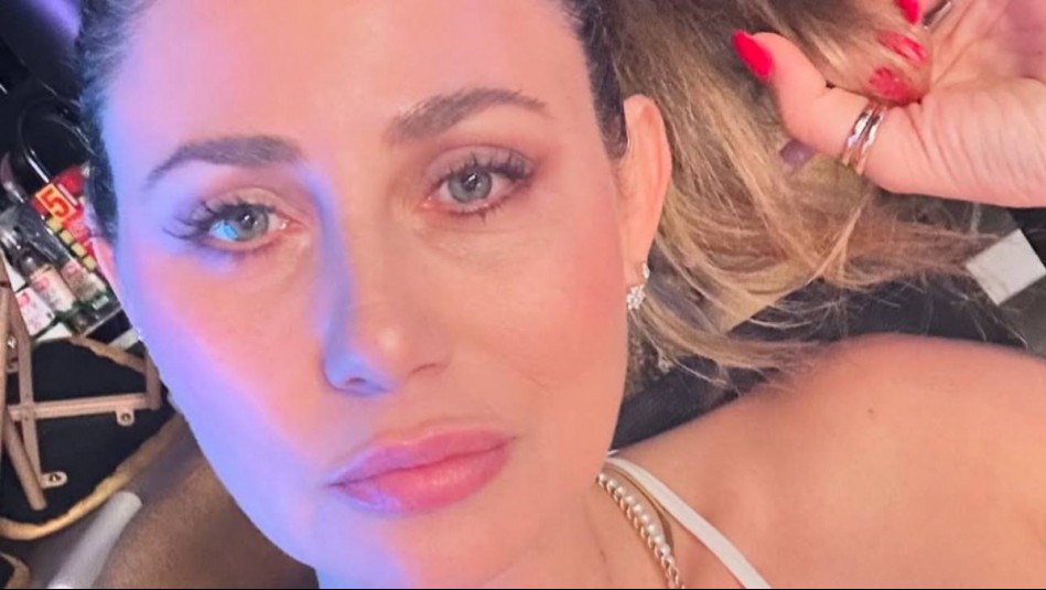 Gissella Gallardo sufre severa lesión por estar distraída en su teléfono: 'El karma me pegó fuerte'