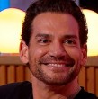 El actor nacional sorprendió a sus seguidores, mostrando el impresionante progreso de su tratamiento estético.
