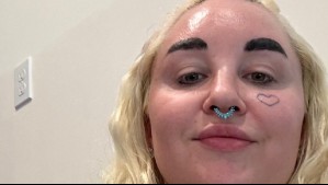 Ex estrella infantil Amanda Bynes sorprende con tratamiento estético: Esta es su turbulenta historia