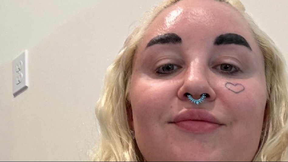 Ex estrella infantil Amanda Bynes sorprende con tratamiento estético: Esta es su turbulenta historia