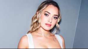 "Gracias bichitos por este new look": Daniela Nicolás se tomó con humor problema que sufrió en su rostro