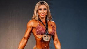 Esculpiendo el cuerpo de una atleta: El tratamiento estético de Nicole Moreno con "tecnología maravillosa"