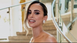 Fran Virgilio renueva su look tras quiebre con Karol Lucero: Estos son los tratamientos capilares que se hizo