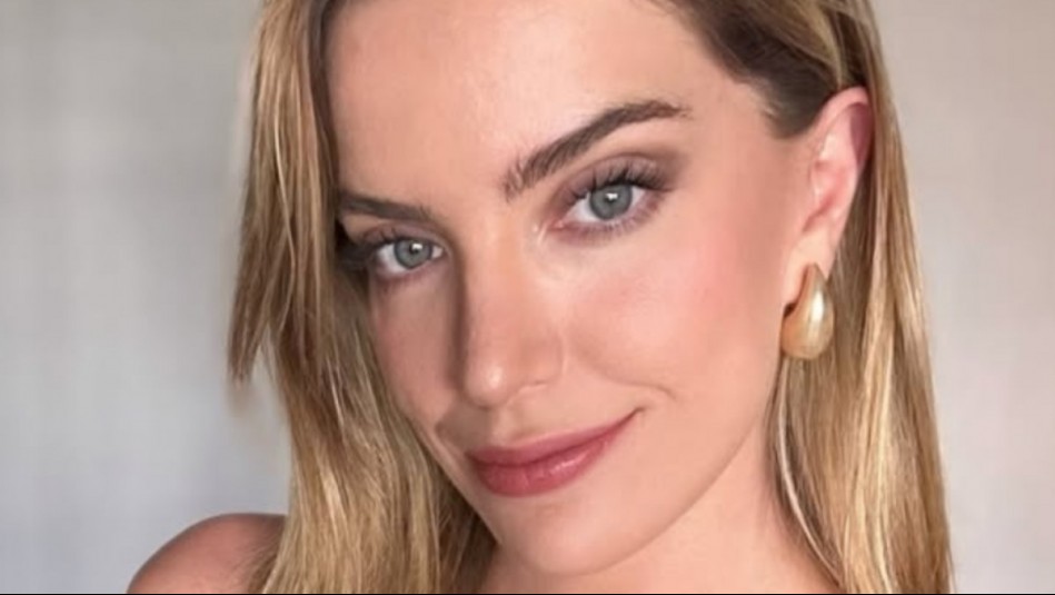 'No podía hablar': Millaray Viera aclara su estado de salud tras preocupación de sus seguidores