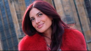 "Me tuvieron que poner una prótesis": Esta fue la compleja operación a la que tuvo que someterse Karen Paola