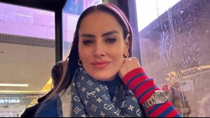 Adriana Barrientos revela el tratamiento que utiliza para retocar sus labios