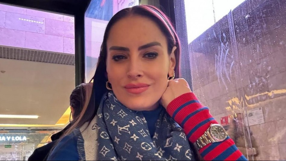 Adriana Barrientos revela el tratamiento que utiliza para retocar sus labios
