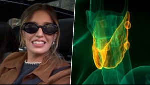 "Una complicación grave con mortalidad importante": ¿Qué es la tormenta tiroidea que sufre Millaray Viera?