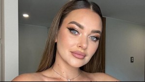 "Se me deformó la cara": Daniela Nicolás relata el terrible 18 que vivió en Miami tras duro accidente