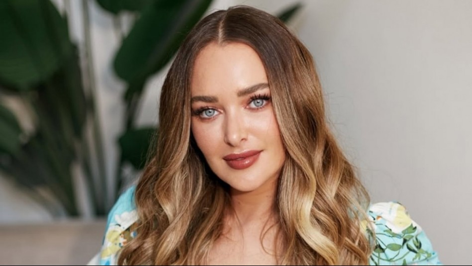 Daniela Nicolás disfruta en las playas de Miami tras sufrir duro accidente: Así evoluciona su rostro