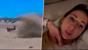 "Tengo fractura...": Rebeca Naranjo sufre duro accidente en moto y muestra sus heridas