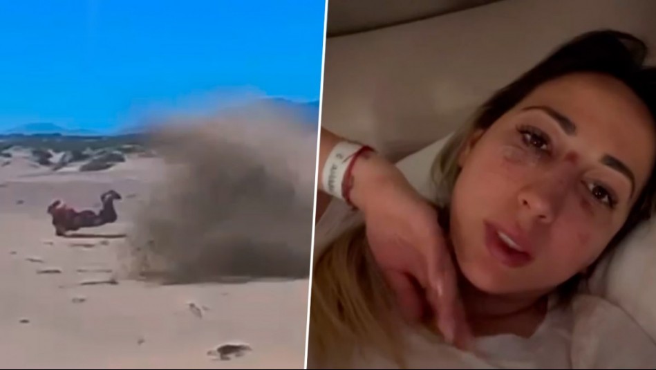 'Tengo fractura...': Rebeca Naranjo sufre duro accidente en moto y muestra sus heridas