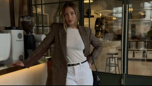 Una piel luminosa y tersa: Florencia Araneda luce los resultados de un tratamiento que transforma el cutis