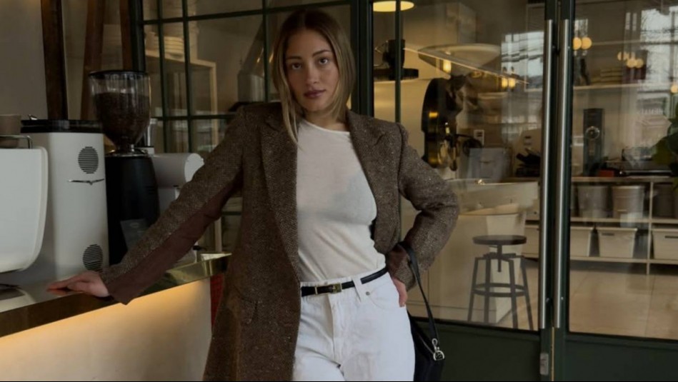 Una piel luminosa y tersa: Florencia Araneda luce los resultados de un tratamiento que transforma el cutis