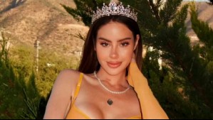 El drástico cambio de look con el que Ignacia Michelson sorprende en redes: Este es el antes y después