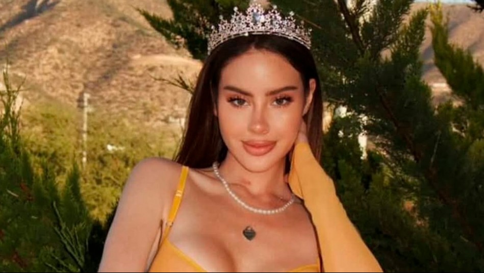 El drástico cambio de look con el que Ignacia Michelson sorprende en redes: Este es el antes y después