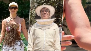 Carla Ochoa y Luis Sandoval muestran las secuelas en su cuerpo tras someterse a reto con miles de abejas