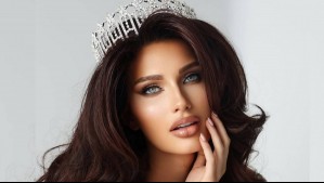 "Algo que nunca imaginé hacer": Candidata con alopecia hace historia al desfilar sin peluca en el Miss USA