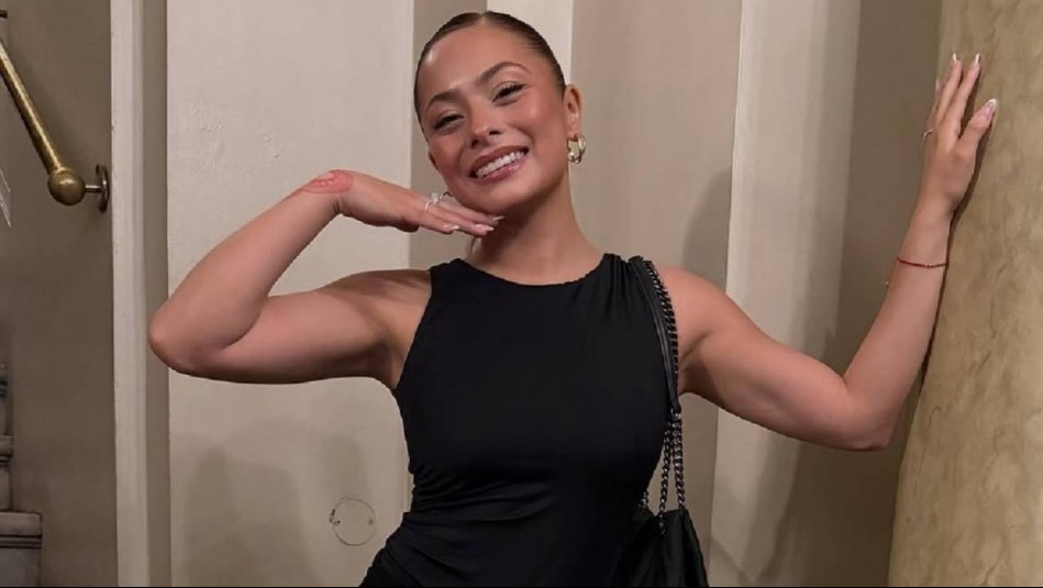 El antes y después de Skarleth Labra tras procedimiento estético: Este es su valor