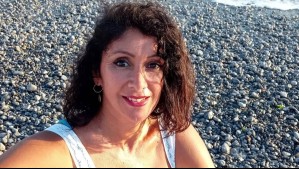 "Aparecieron las arrugas": Este es el tratamiento estético al que se sometió Angélica Sepúlveda