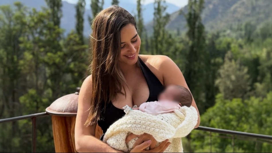 'Ya tiene un glow distinto': Melina Noto reveló qué tratamiento sigue para sus manchitas postparto en su piel