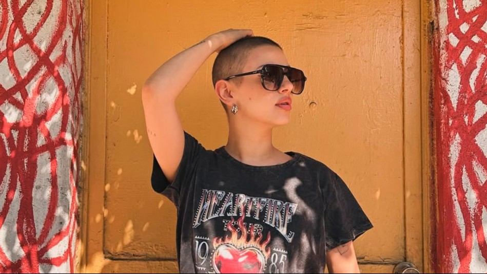 'Verme pelada fue lo más duro': Karla Melo se sincera tras terminar tratamiento contra el cáncer