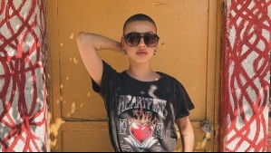 "Esto se va a ir": Karla Melo se somete a procedimiento estético tras superar polémica con restaurante