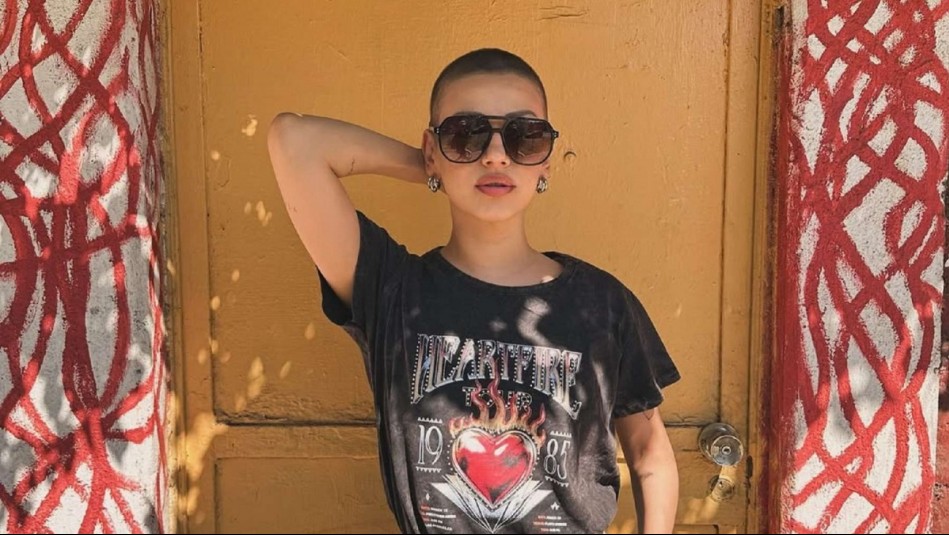 'Esto se va a ir': Karla Melo se somete a procedimiento estético tras superar polémica con restaurante